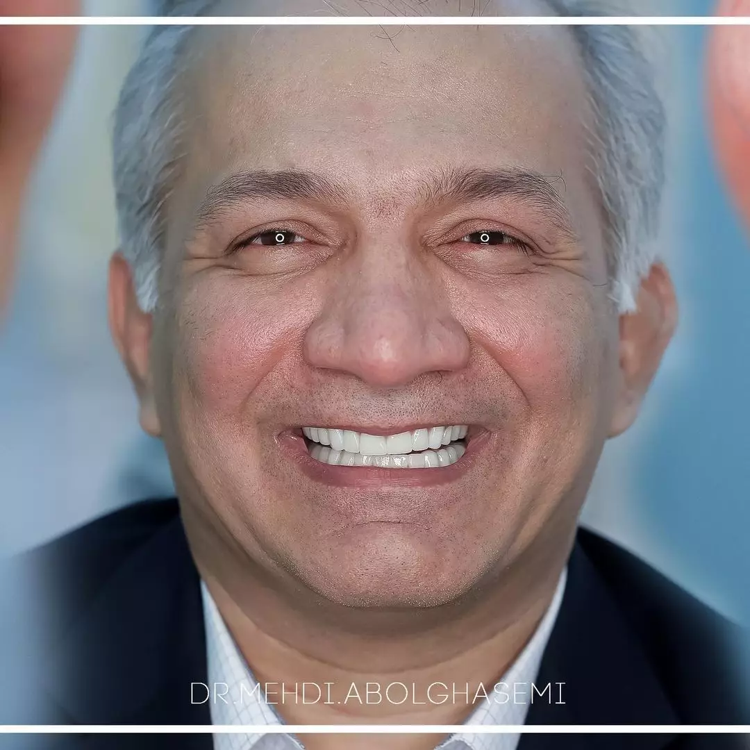 گالری اینستاگرام4