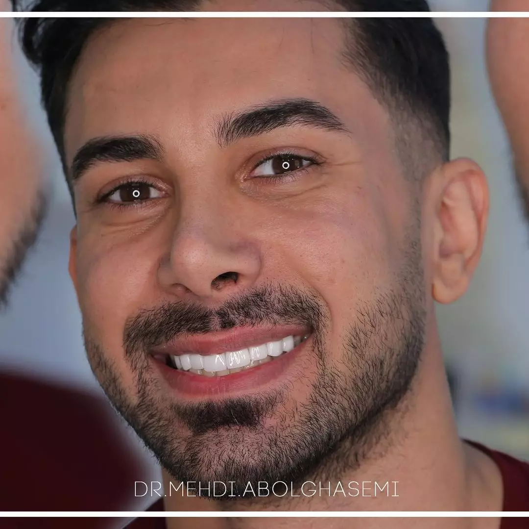 گالری اینستاگرام3