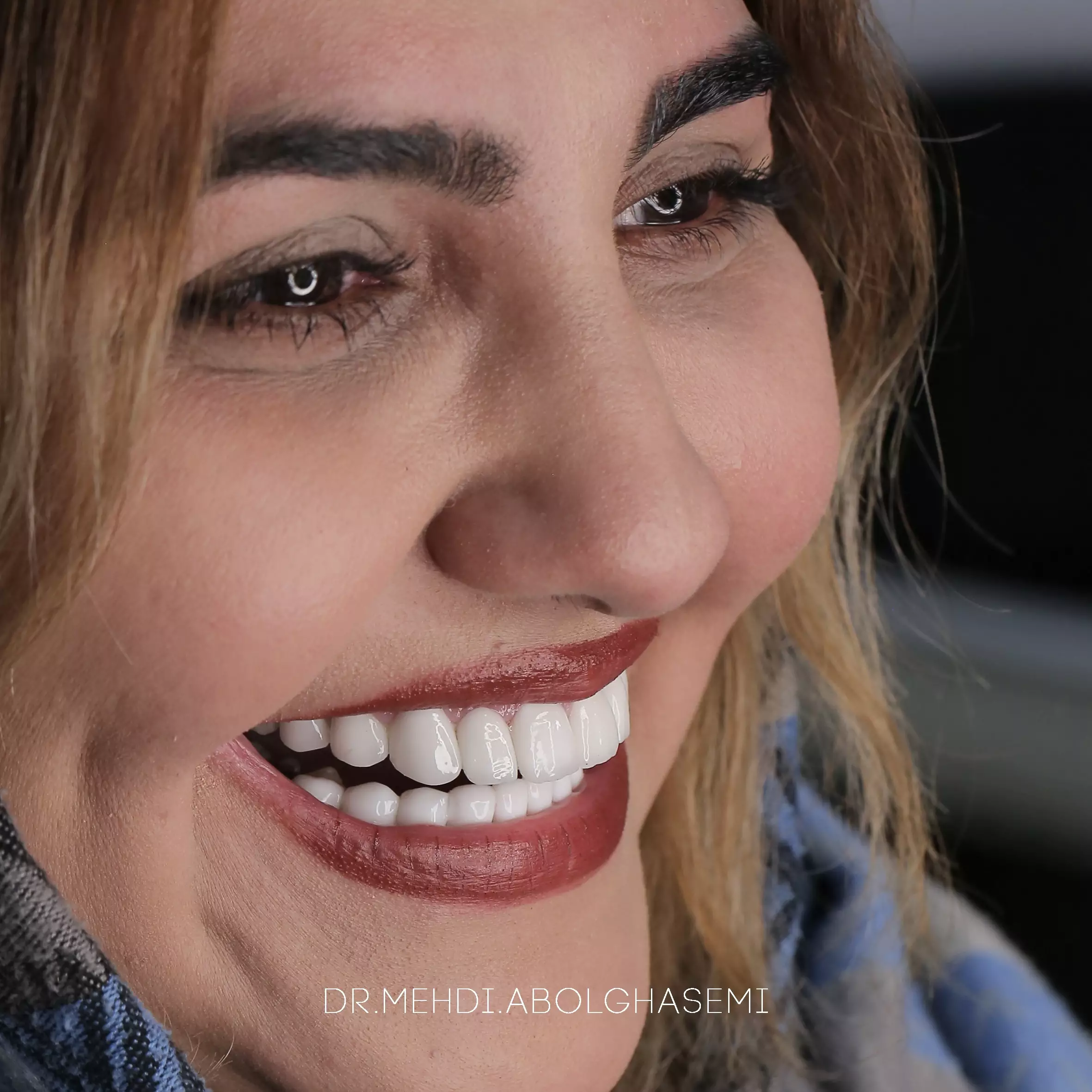 گالری تصاویر