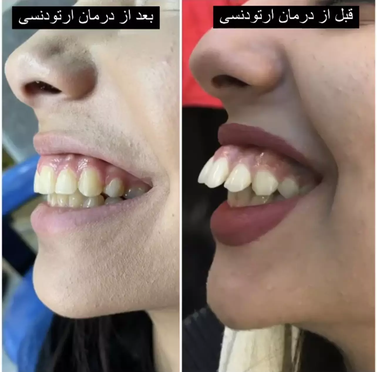 تصاویر ارتودنسی