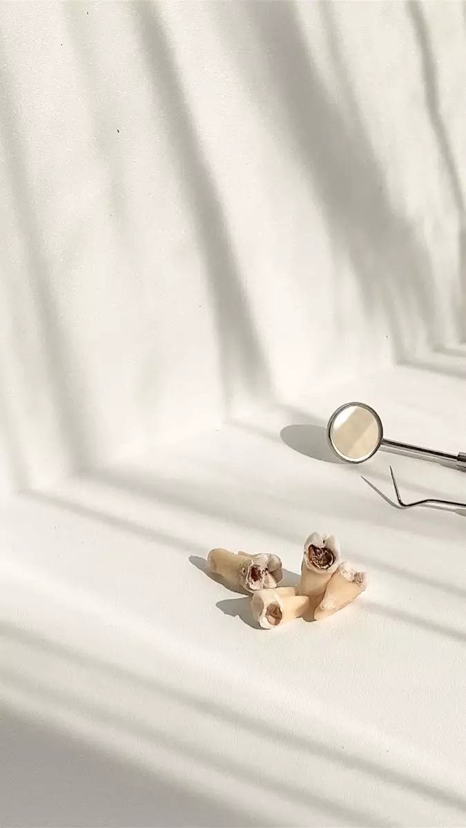 کشیدن و جراحی دندان عقل