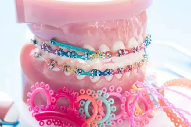 تصاویر ارتودنسی