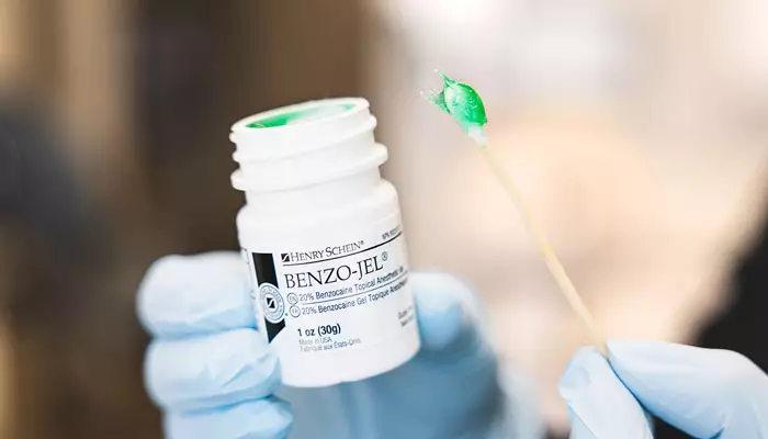 آشنایی-با-انواع-بی-حسی-دندان