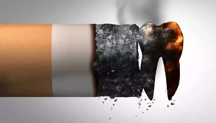 اثرات مخرب سیگار بر دندان
