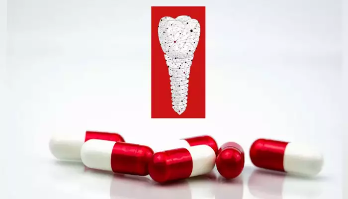 بهترین-آنتی‌بیوتیک-برای-عفونت-ایمپلنت-دندان1