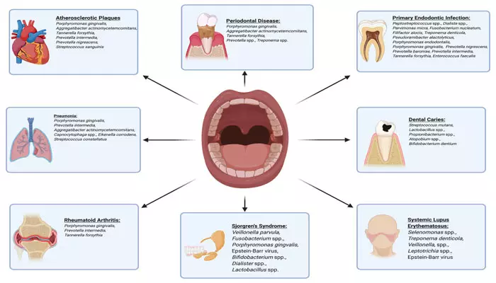 بیماریهای-دهان-و-دندان-با-سلامت-بدن1