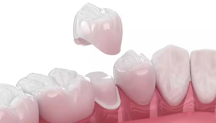 ترمیم-و-درمان-دندان