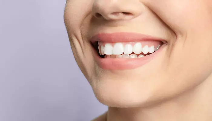 خط-لبخند-چیست1