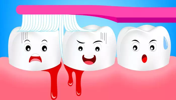 عوارض-خونریزی-لثه