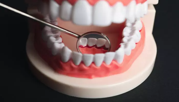 عوارض-خونریزی-لثه