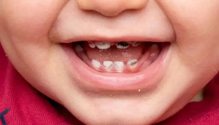 مصرف-قطره-اهن