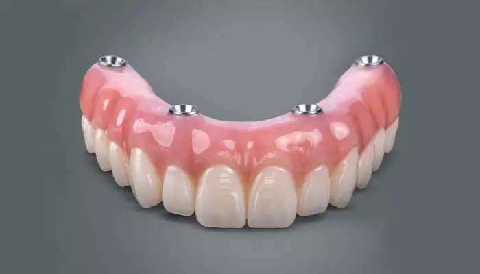 پروتز-دندان2