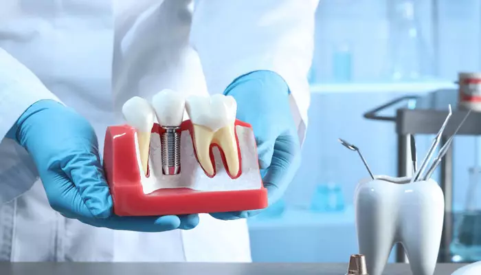 پوکی-استخوان-و-ایمپلنت3