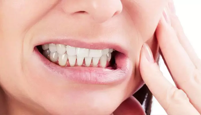 براکسیسم یا دندان قروچه چیست