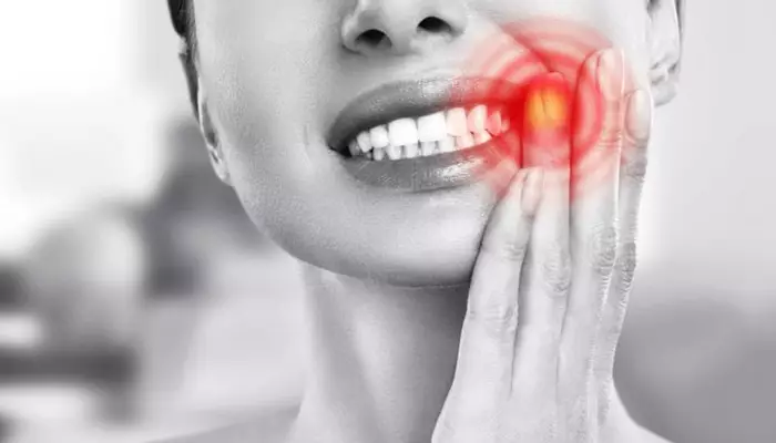 کیست دندان چیست