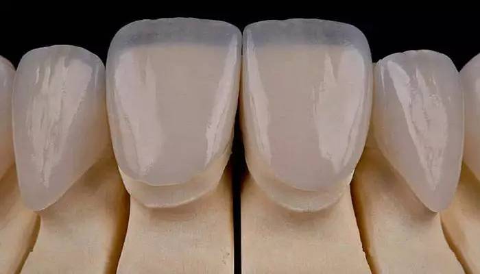 انواع برندهای لمینت