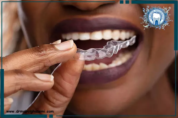 نایت گارد و درمان دندان قروچه