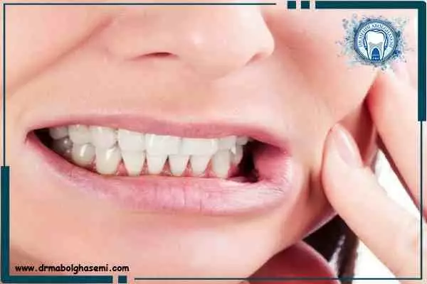 دندان قروچه یا براکسیسم