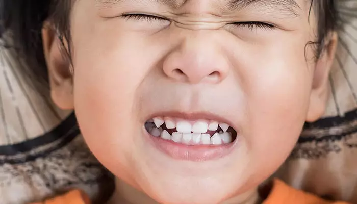 دندان قروچه در کودکان