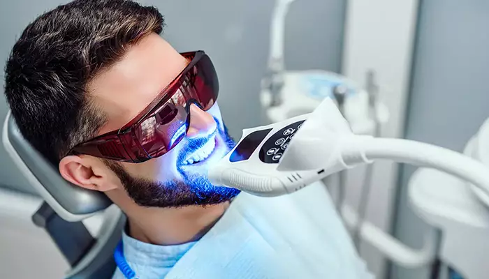 بلیچینگ دندان