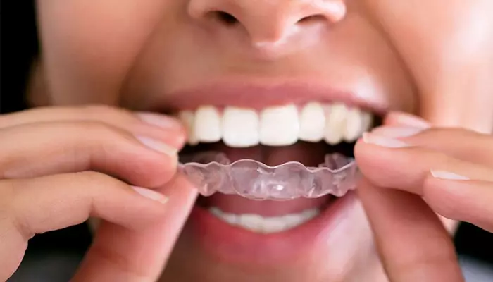 درمان کلینیکی دندان قروچه در خواب