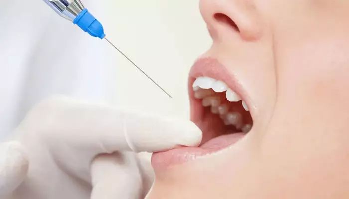 آشنایی-با-اسپری-های-بی-حسی-دندان