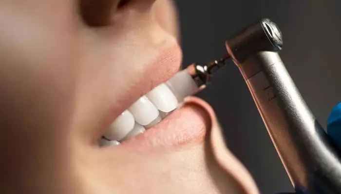 آشنایی-با-اسپری-های-دندان1