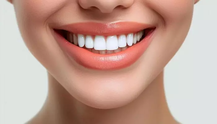 اصلاح-طرح-لبخند-هالیوودی