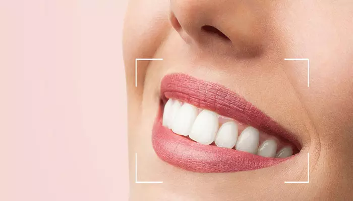 اصلاح-طرح-لبخند-هالیوودی2