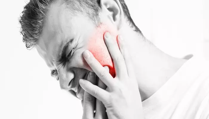 دندان درد شدید