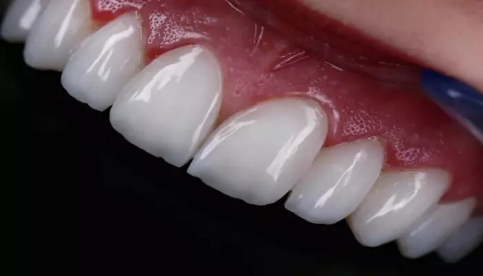 کامپوزیت شیشه ای