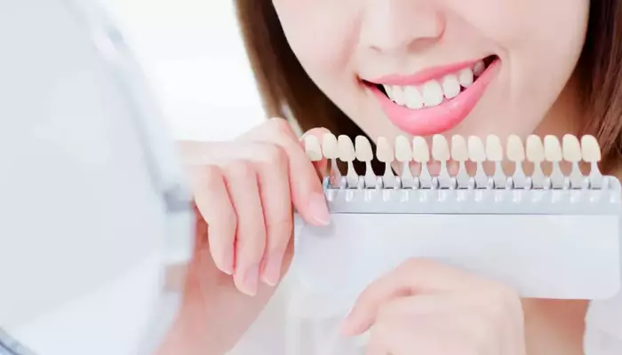 انواع رنگ کامپوزیت