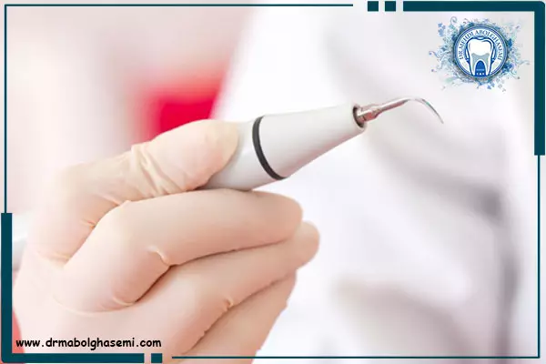 جرم گیری دندان با دستگاه اولتراسونیک