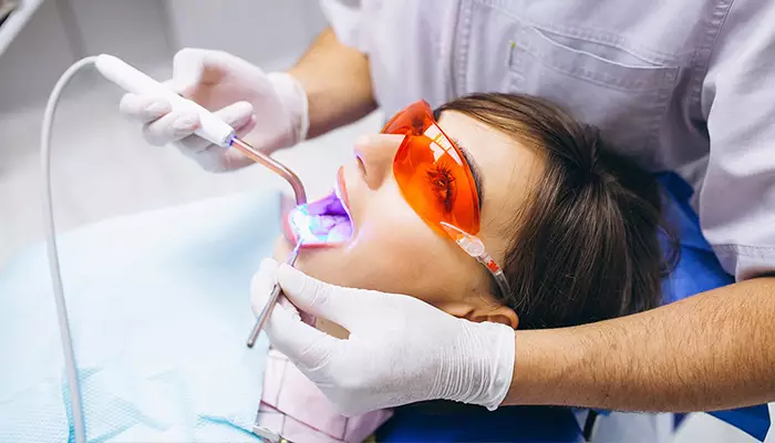 سفید کردن دندان با لیزر چیست
