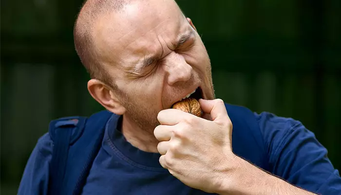 مراقبت های بعد از لمینت دندان