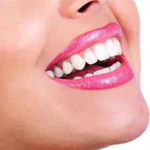 تصویری از یک لبخند زیبا